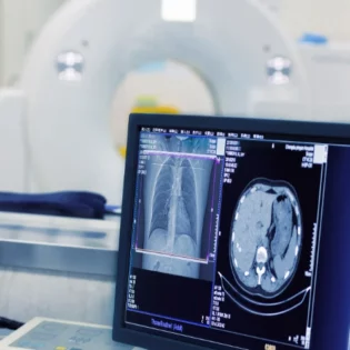 X-Ray